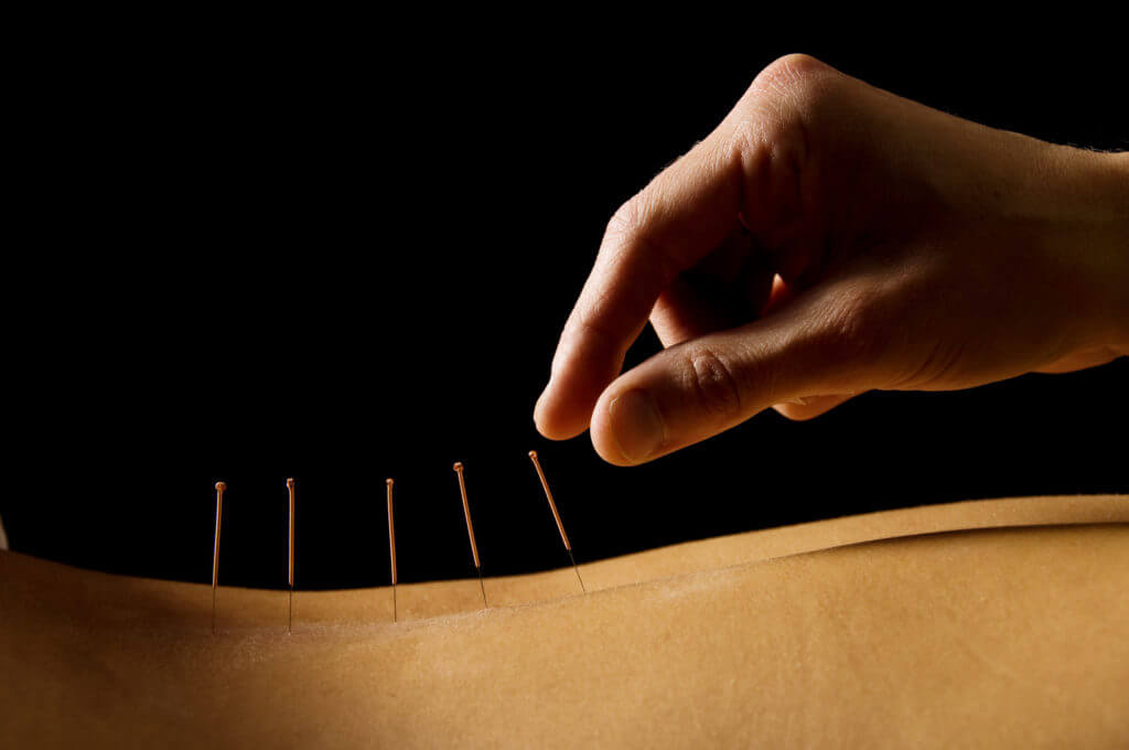 Acupuncture Promising for Pain Relief from Some Breast Cancer Treatment