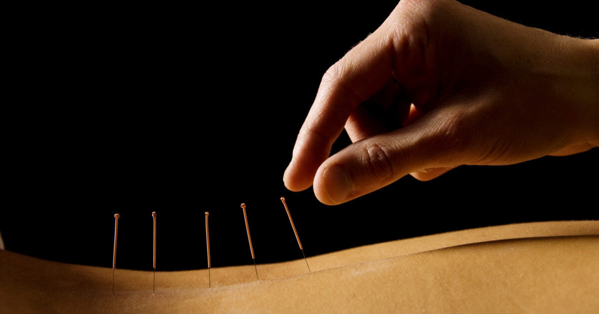 Acupuncture Promising for Pain Relief from Some Breast Cancer Treatment