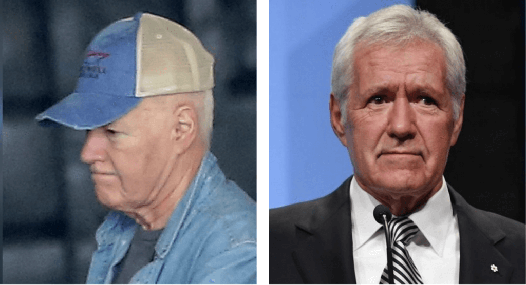 Alex Trebek shown in two pictures, one with a baseball cap and another with a wig due to hairloss