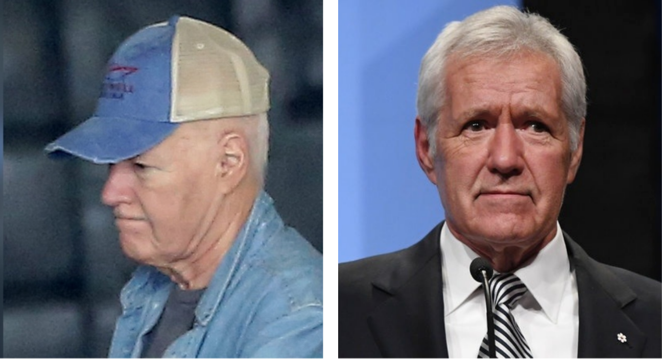 the left picture is a picture of trebek with a beige and blue baseball cap and jean jacket. the right photo is a picture of him in a suit wearing a wig after losing his hair due to chemotherapy