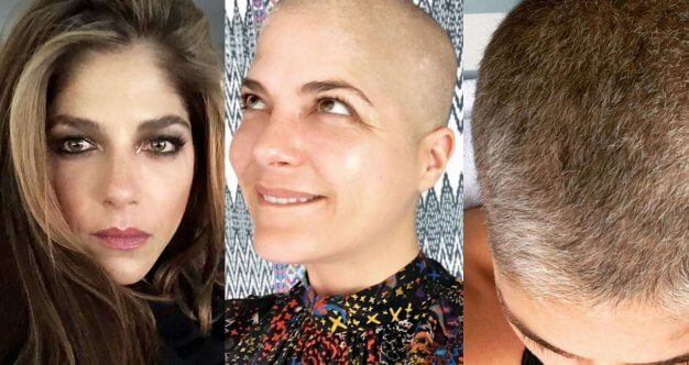 Actress Selma Blair Embraces the Patchy, Grey Hair She's Growing Back After  Chemo | SurvivorNet