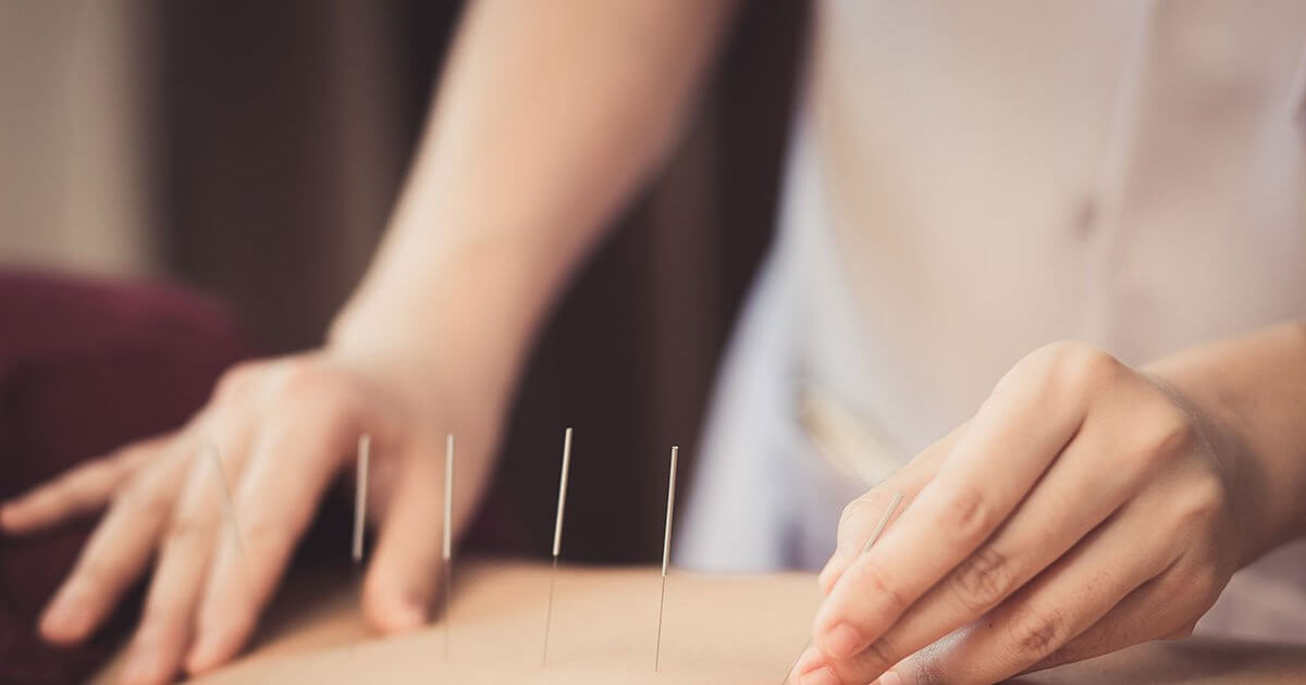 Good News Acupuncture May Offer Relief for Radiation Dry Mouth