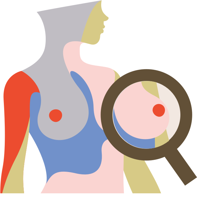 Premium Vector  Woman after mastectomy a girl without breasts tries on a  breast prosthesis breast cancer vector illustration