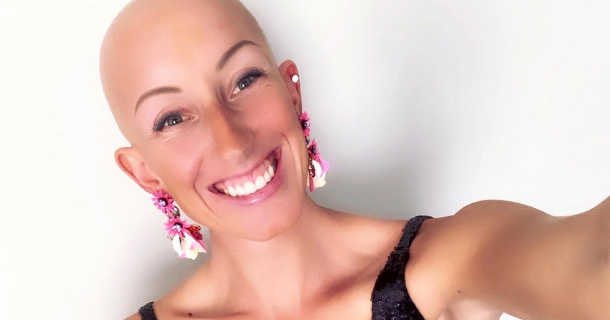 Marathoner Lindsay Walter On Embracing Her Baldness with Bravery After