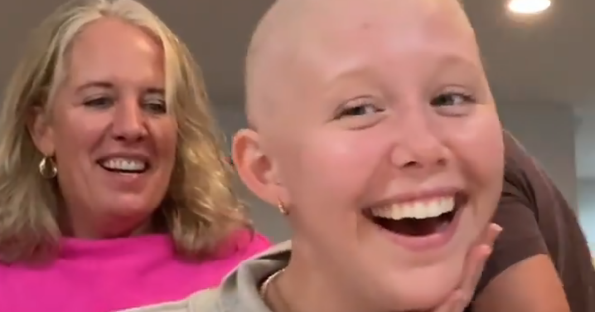 I Did a Thing!': 19-Year-Old Actress Miranda McKeon Shaves Her Head Before  Final Round of Chemo; Breast Cancer in Young Women & How to Cope With Hair  Loss | SurvivorNet