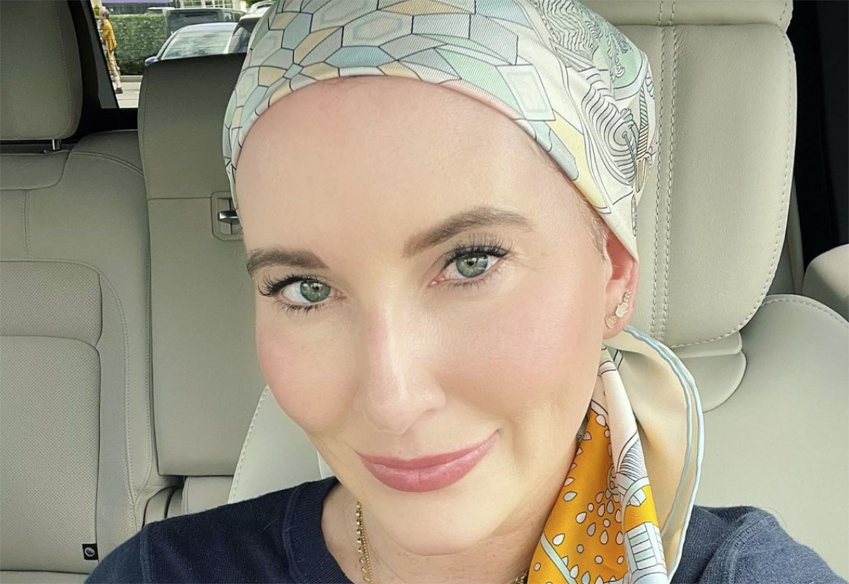 Please Stop Complimenting My Post-Chemotherapy Hair