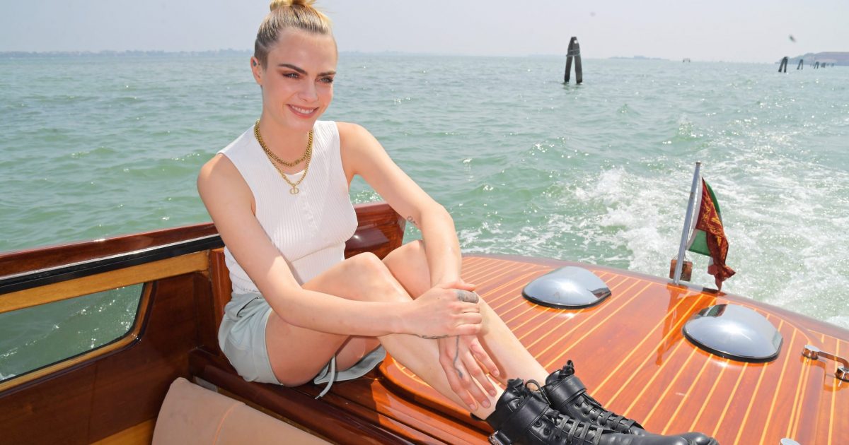 Cara Delevingne Reveals Scabby Legs Amid Psoriasis Fight