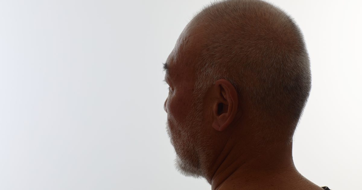 Dermatologists Alert Stranger to Mark on His Face It Was Skin Cancer